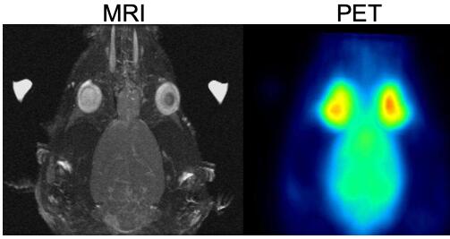 MRI